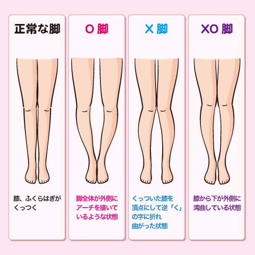 あなたの脚はどのタイプ？